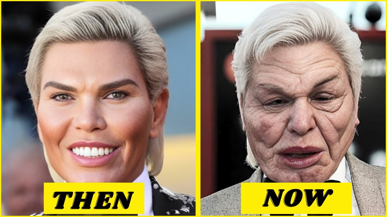 45 Celebrity Plastic Surgery Disasters That Shocked Hollywood full album