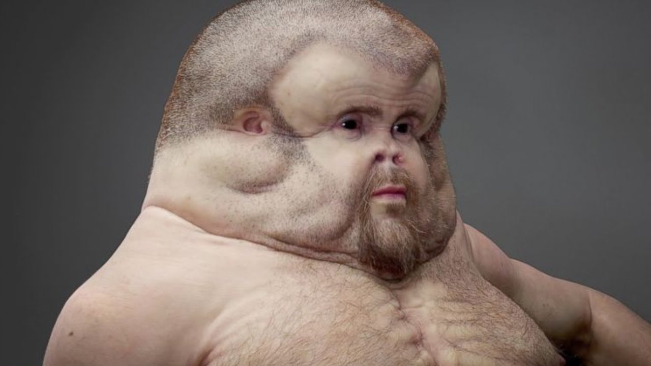 What Humans Would Look Like If They Evolved To Survive Car Crashes