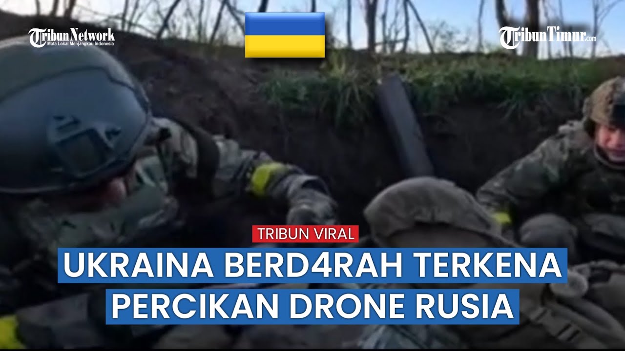 Alami Luka Parah, Tentara Ukraina Kena Tembakan Tentara Rusia