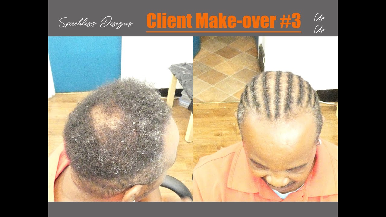 HOW TO BRAID OVER  BALD PATCH