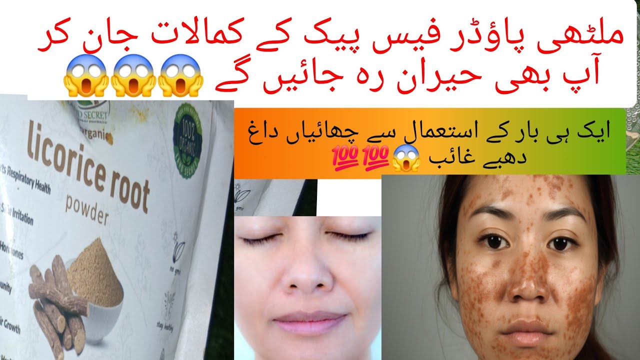 Pigmentation, pimples Finish ❌️ Mulathi powder ka jadoo | Clear glass skin Naturally 