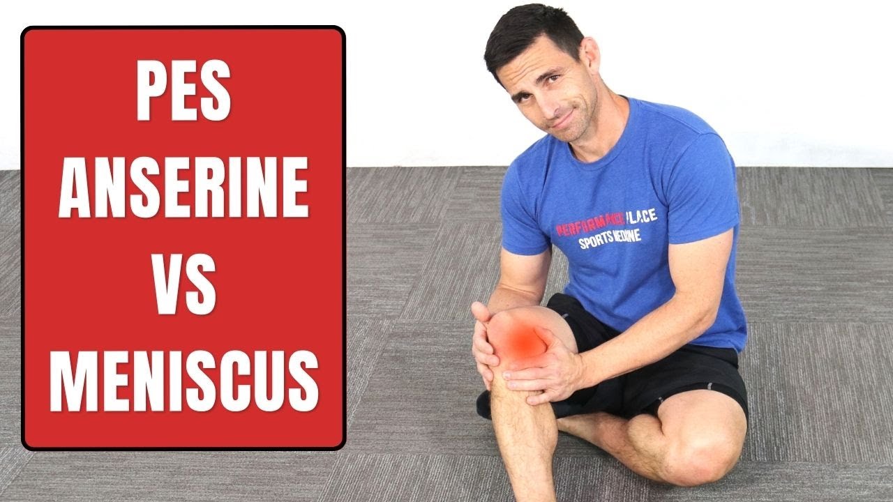 Pes Anserine Bursitis Vs. Medial Meniscus Injury