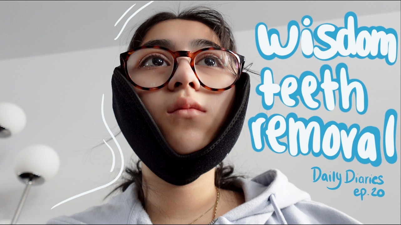 Je me fais enlever les dents de sagesse 😳🦷 -- Daily Diaries Ep.20