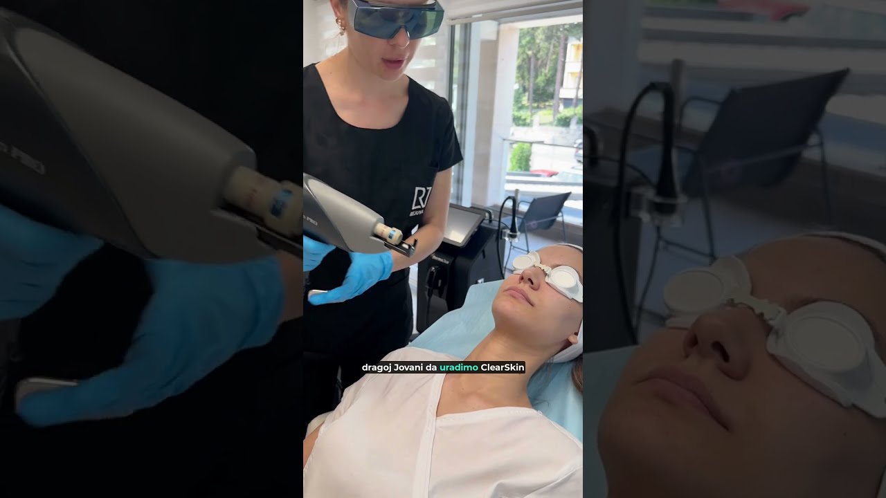 Harmony XL Pro ClearSkin laserski tretman u Rejuvi