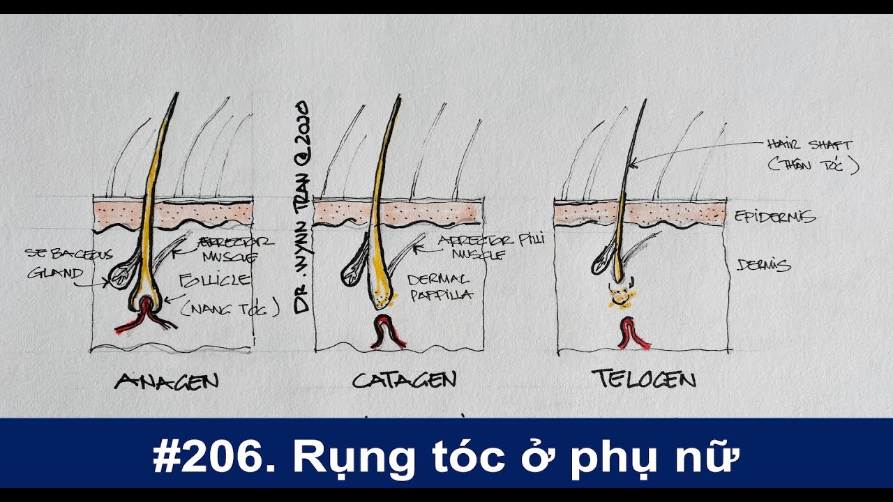 #206. Rụng tóc ở phụ nữ và cách chữa trị?