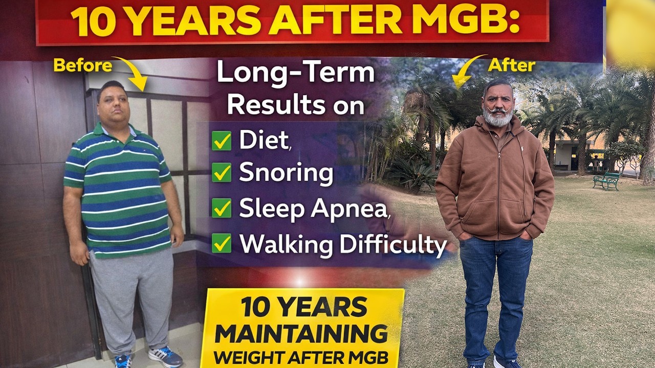 Decade After MGB: Long-Term Results on Diet, Snoring, Sleep Apnea & Walking Difficulty.@Dr K S Kular