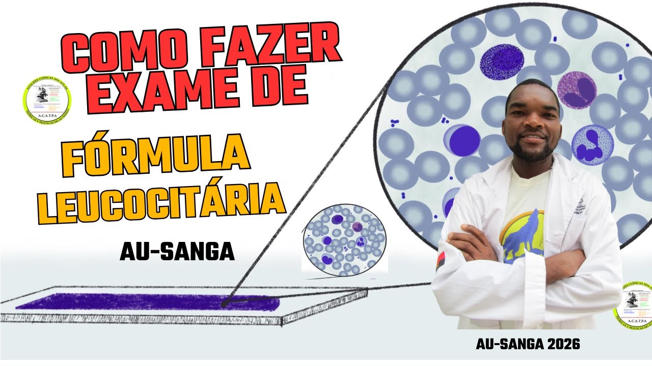 Como fazer exame de Fórmula Leucocitária. Com Au-Sanga