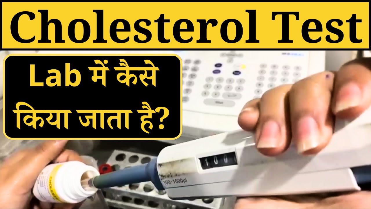 Cholesterol Kya Hai ? Cholesterol Test Kaise Hota Hai, Principle & Procedure, Lab Practical