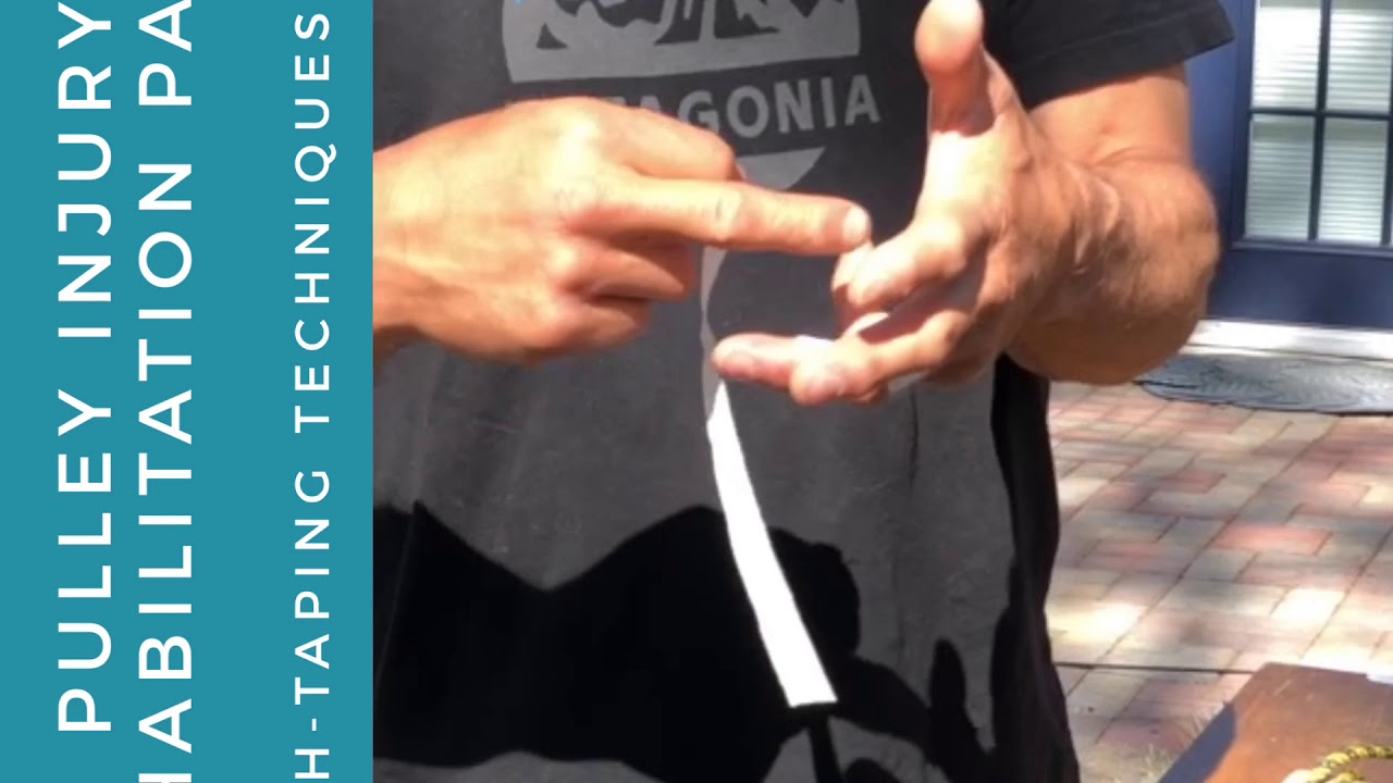 Pulley Injury Rehabilitation: Part 2 H-Taping