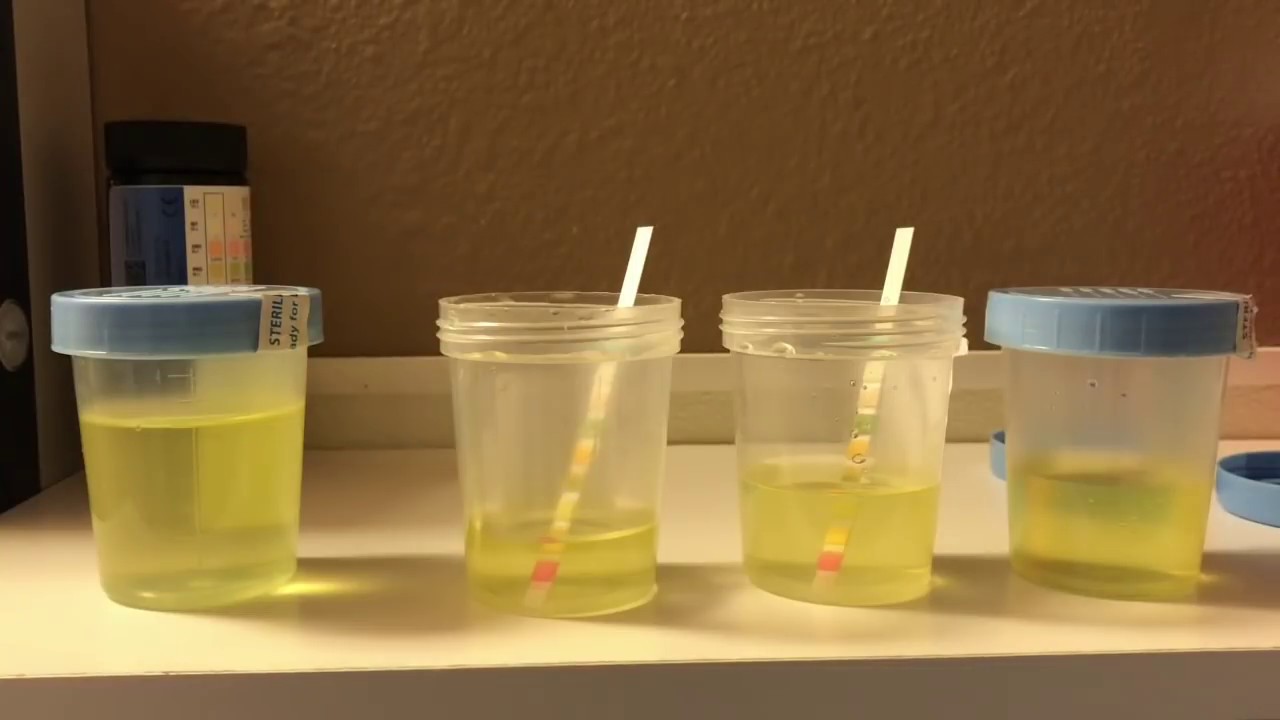 How To Detect Synthetic Urine ( QuickFix )