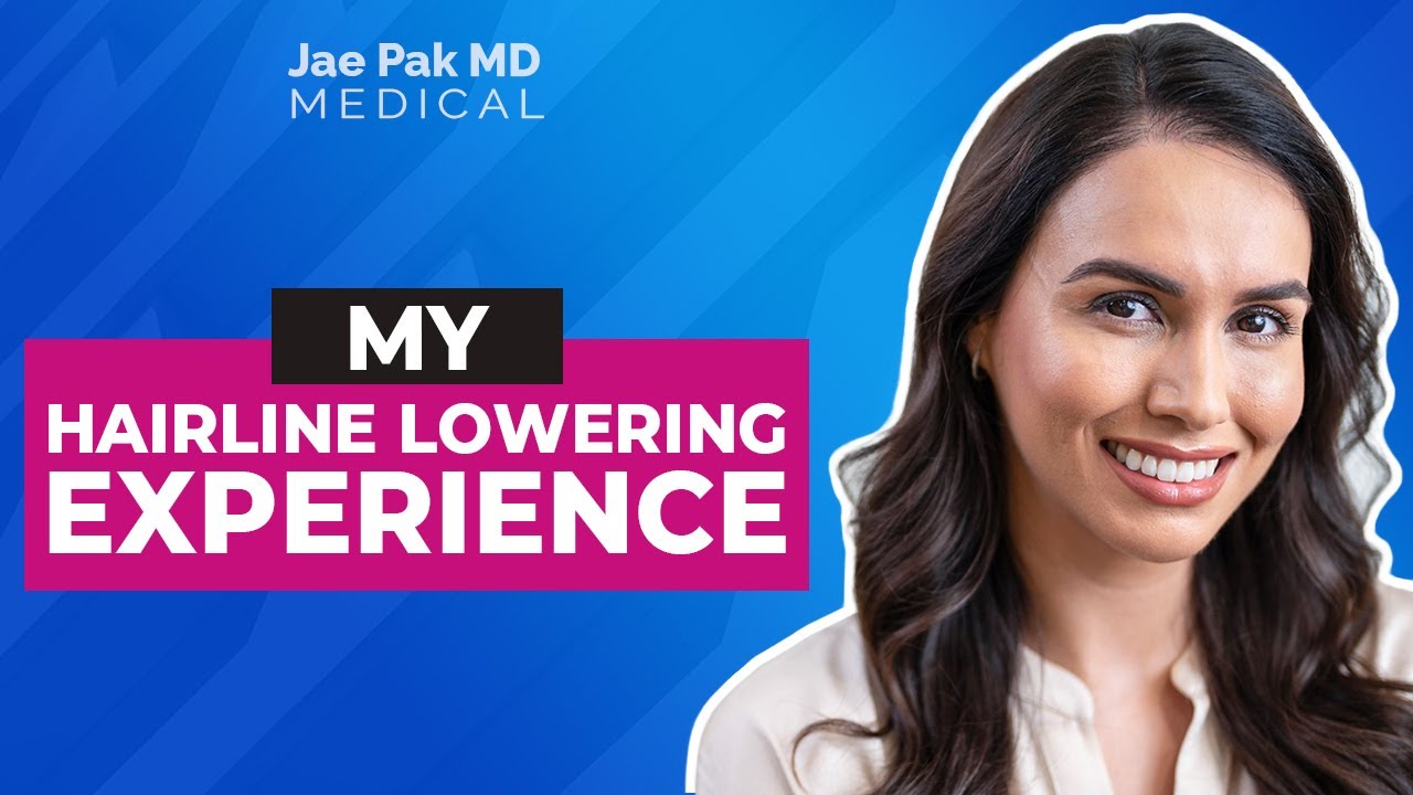 My Hairline Lowering Experience with Jae Pak MD Medical