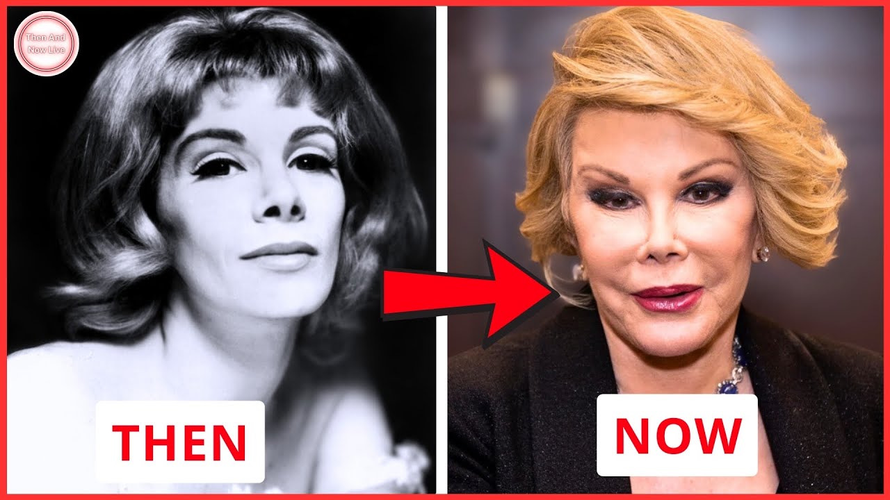 35 Celebrities Who Went Too Far with Plastic Surgery | Then and Now 2026