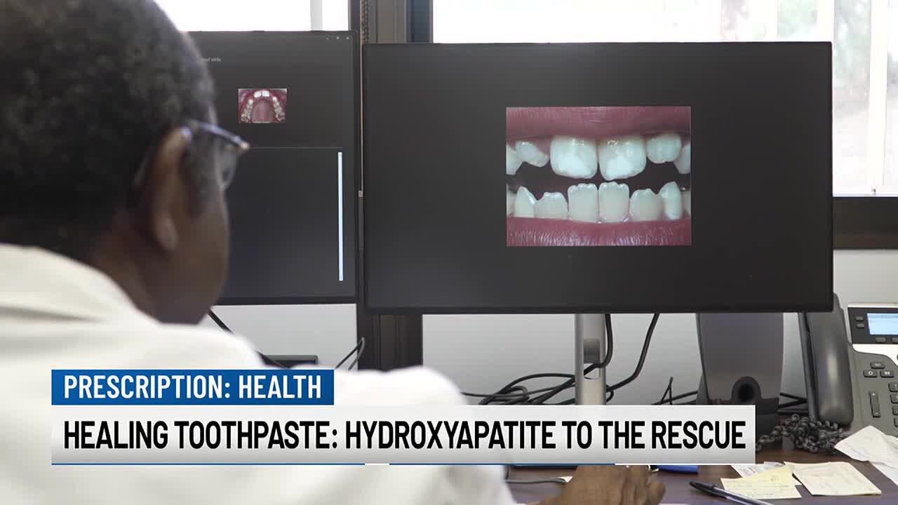 Healing toothpaste: Hydroxyapatite to the rescue