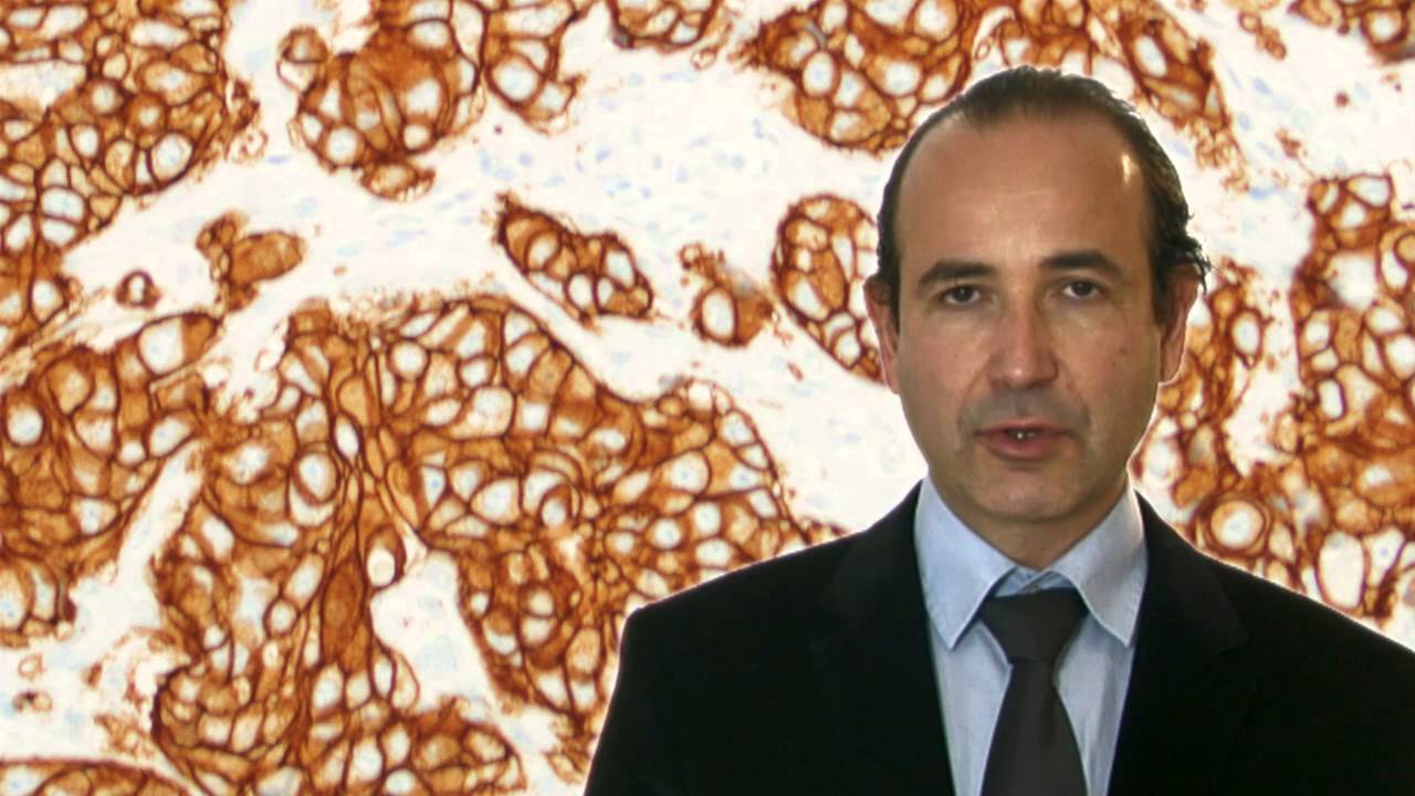 Curso Biomarcadores en Oncolog&iacute;a