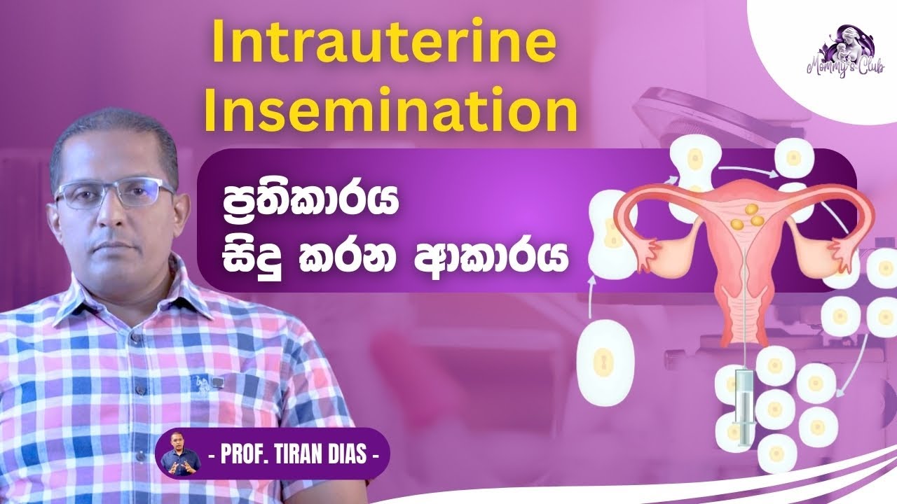 Intrauterine Insemination (IUI) ප්‍රතිකාරය සිදුකරන ආකාරය