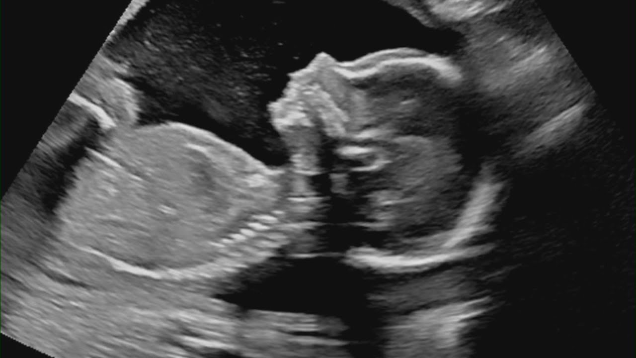 Ask Ellen: Are you pregnant?