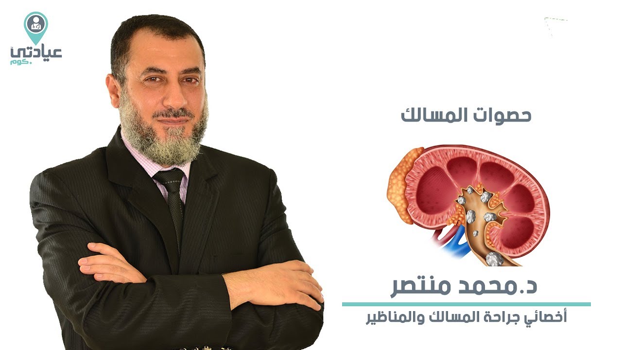 حصوات المسالك البولية مع د : محمد منتصر – دكتورمسالك بولية بدمياط