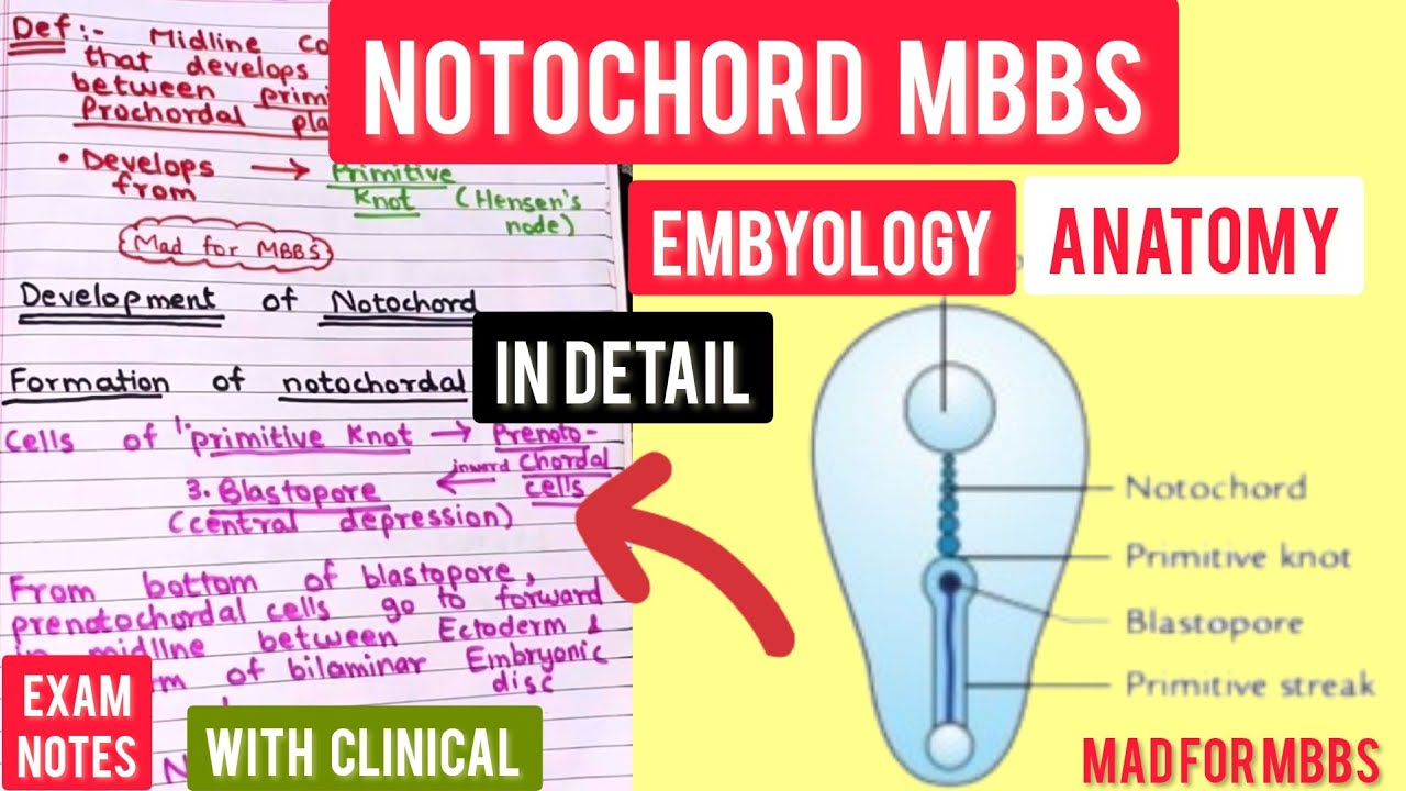 Notochord MBBS | Very Eassyy | Embryology | In Detail with clinical|Handwritten notes|Anatomy