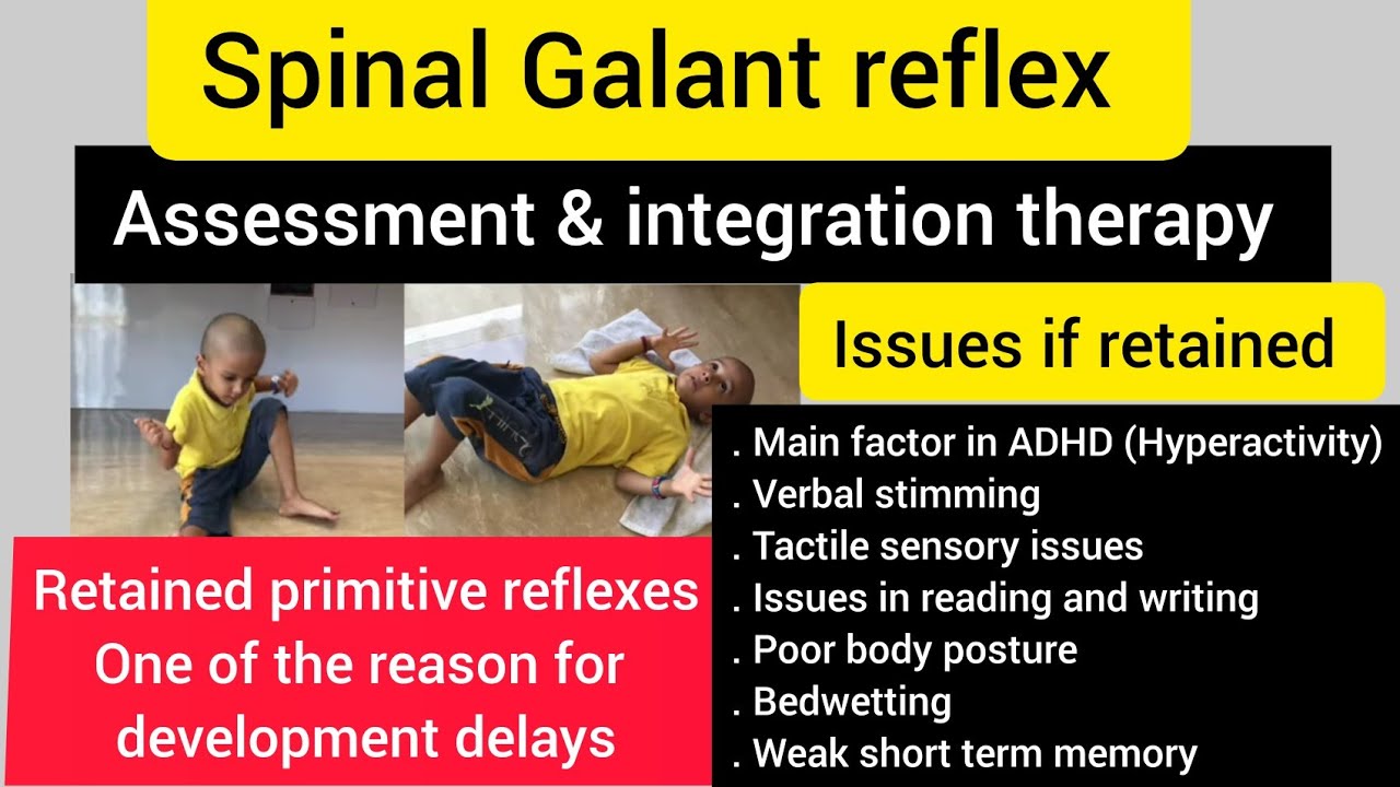 Spinal galant reflex/how to integrate retained spinal galant reflex/OT/primitive reflex integration