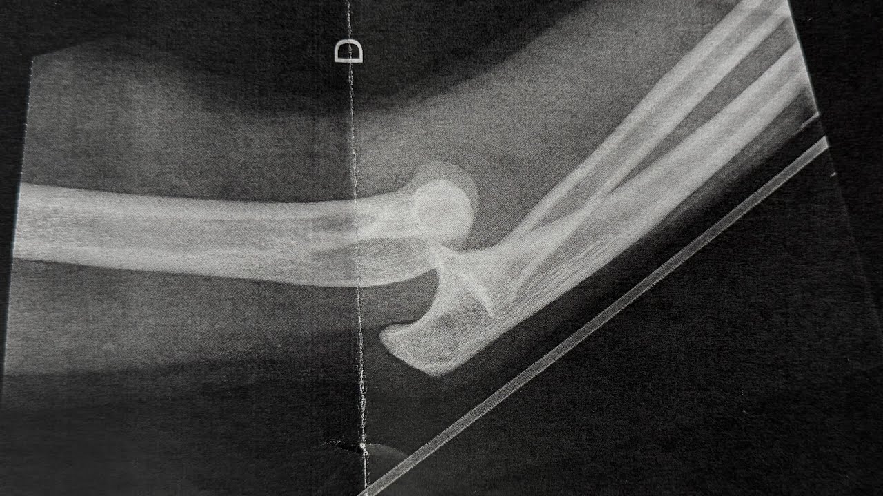 This Is How It Happened… and Recovery starts Here / EP01