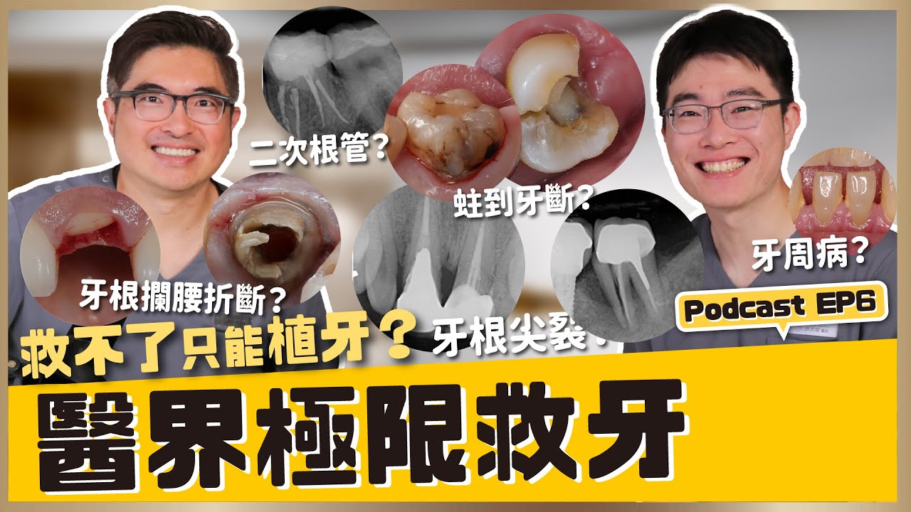 醫界極限救牙真相公開！牙齒斷掉還有救？救與不救的分界線：牙科臨床上的極限挑戰 ft. 許文斌｜【祐民牙醫－隱適美旗艦店】鑽石級楊大為醫師
