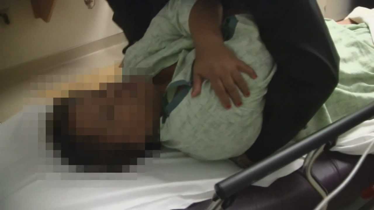 Rib Dislocation Emergency