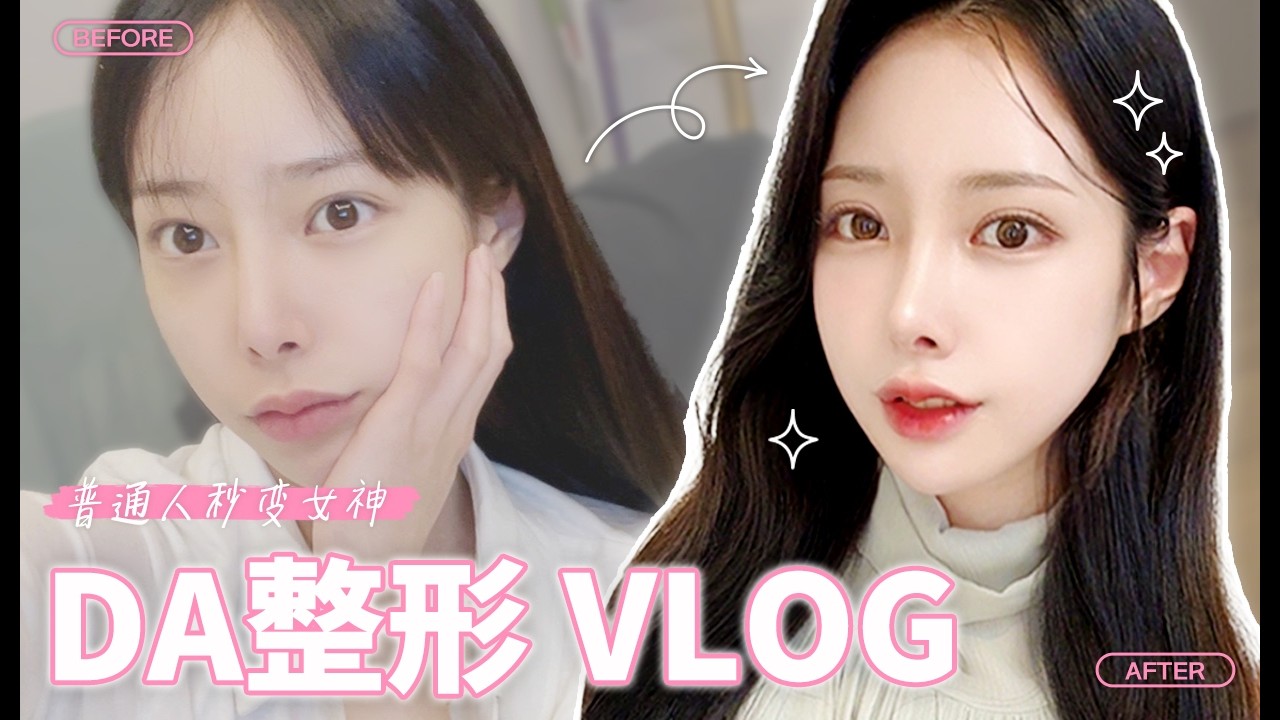 【韩国DA整形】韩国DA整形vlog——普通人秒变女神！