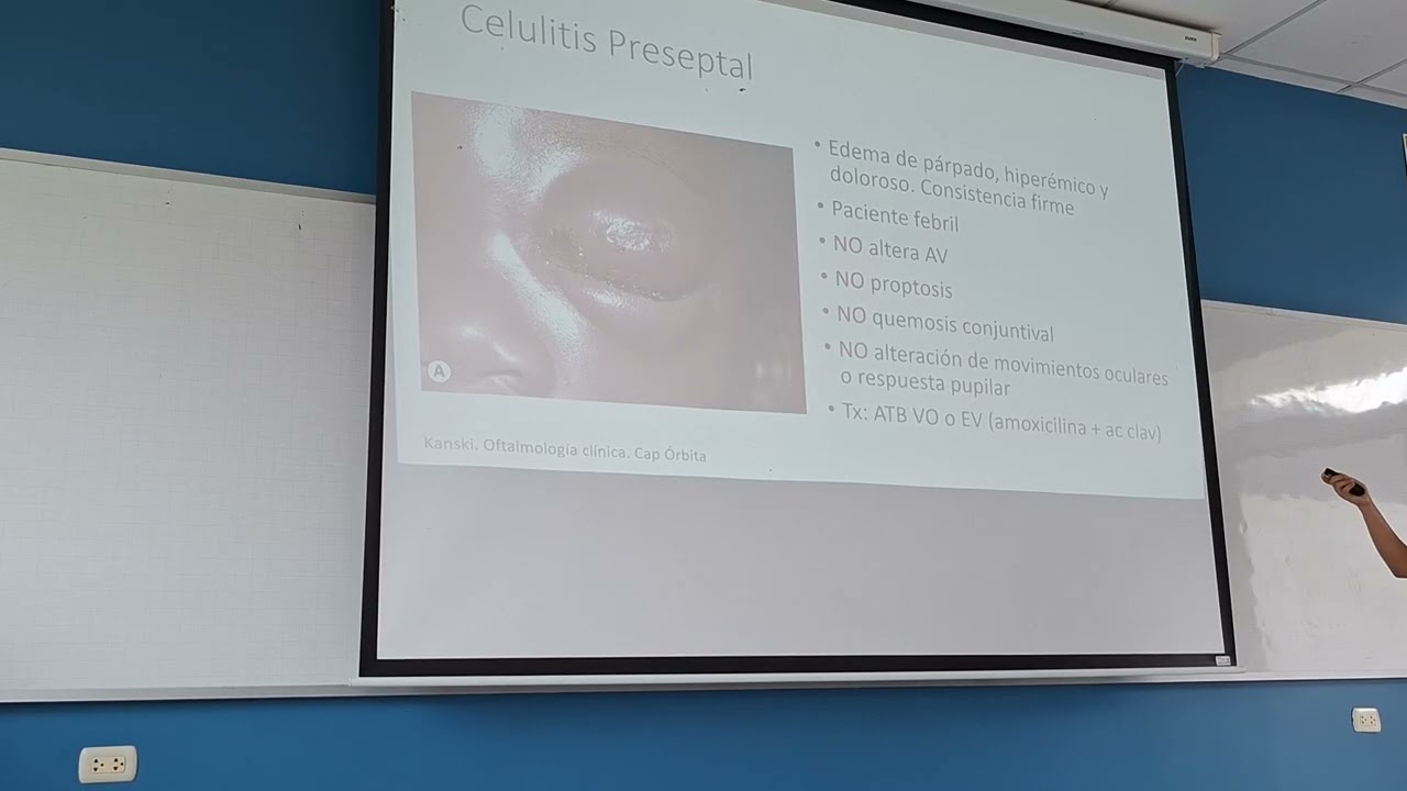 Oftalmo - Clase 4 Parte 1