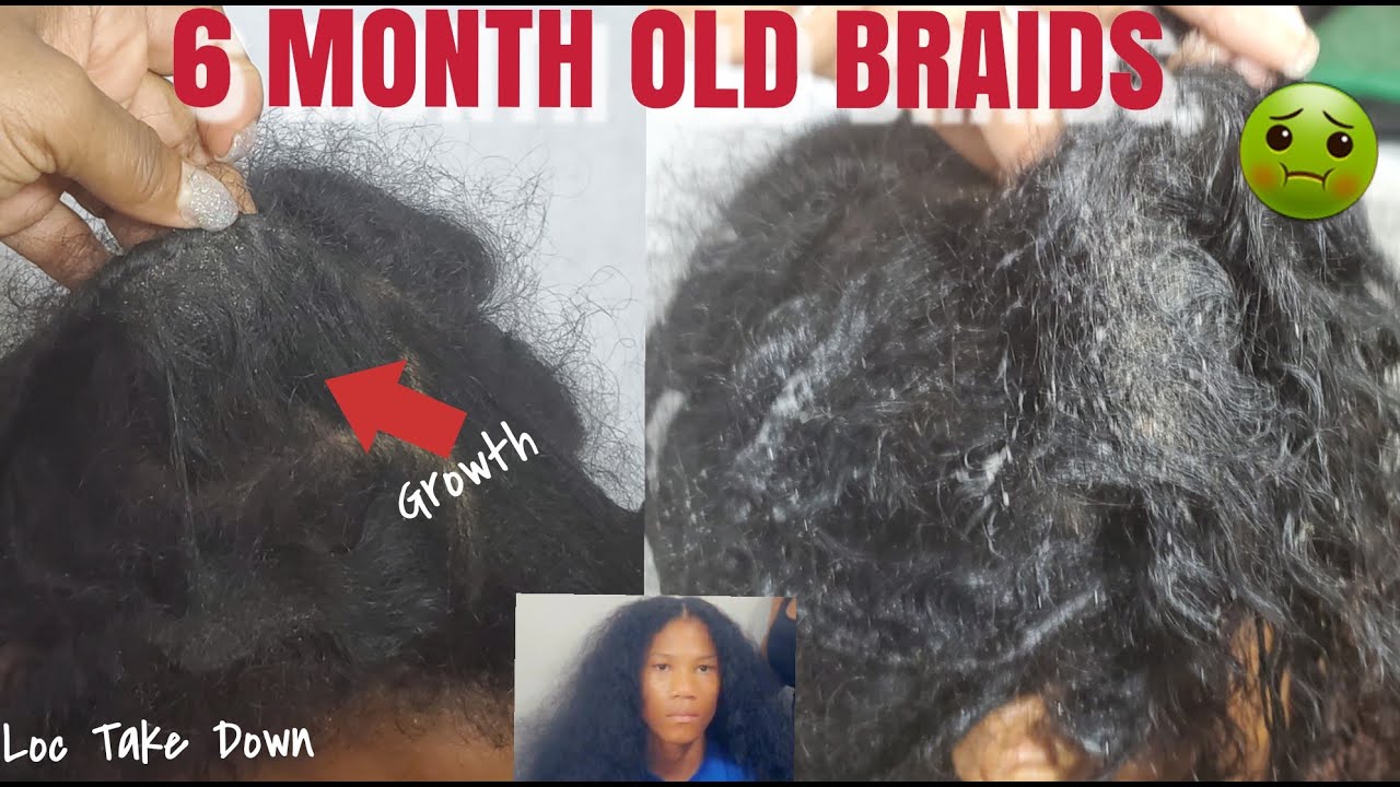 Safely Take Down 6 Month Old Braids | Amazing Growth | Combing Out Dreadlocks | Locs take Down