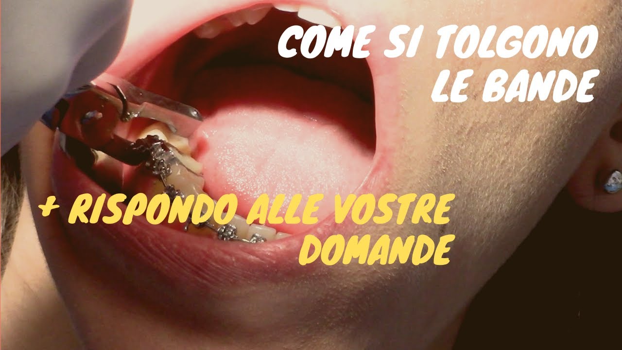 Come si tolgono le bande (+ rispondo alle vostre domande)