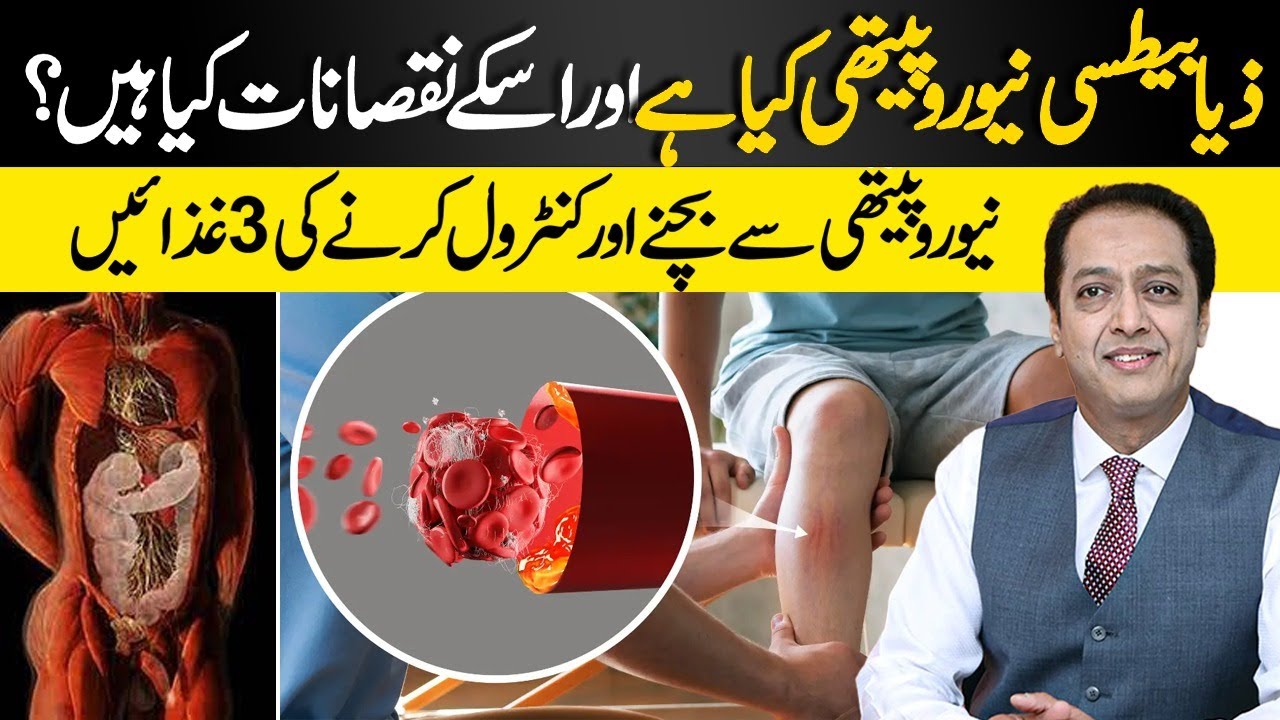 What Causes Diabetic Neuropathy? | Problems, Causes & Solutions | Dr Shahid Nadeem