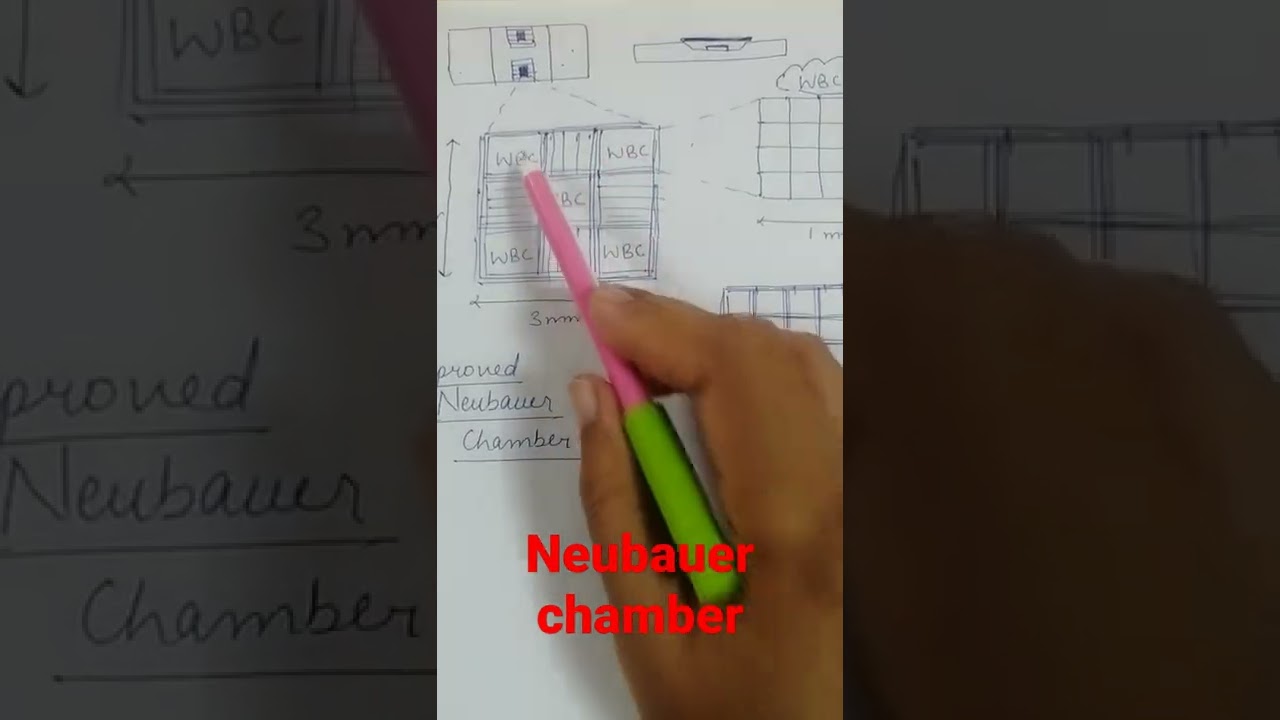 Камера Нойбауэра