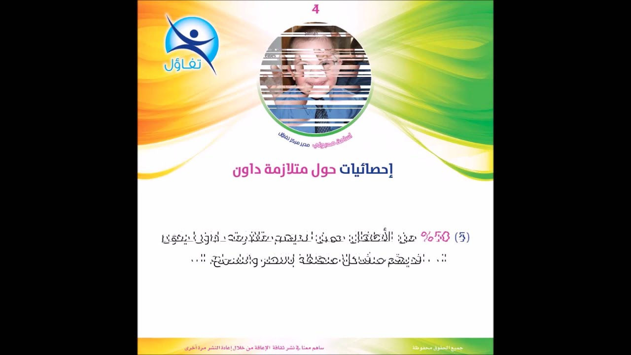 إحصائيات حول متلازمة داون - اسامة مدبولى