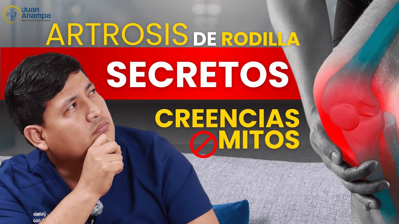 ¡Lo Que NO SABÍAS Sobre la ARTROSIS de RODILLA! 