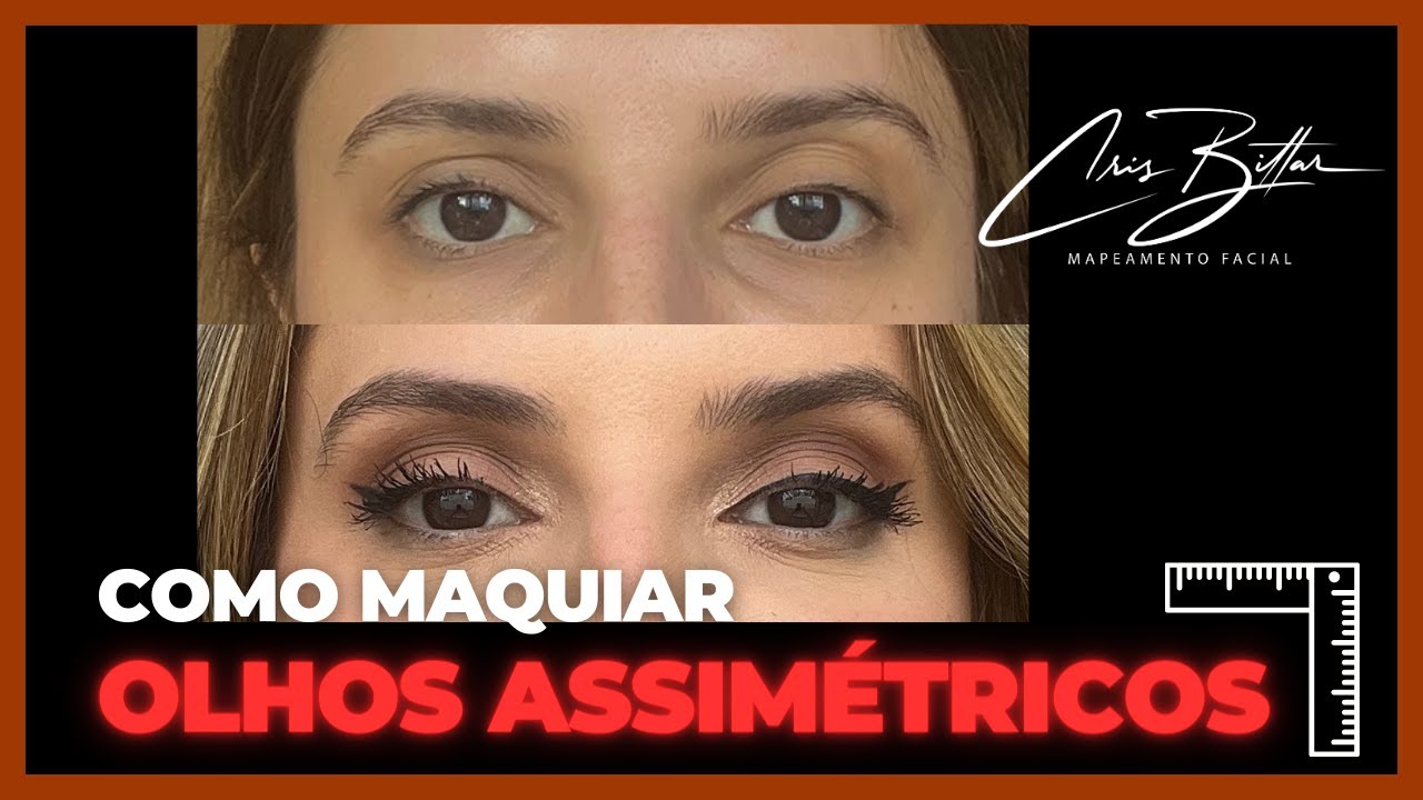 Assimetria dos Olhos - Mapeamento Facial | Cris Bittar