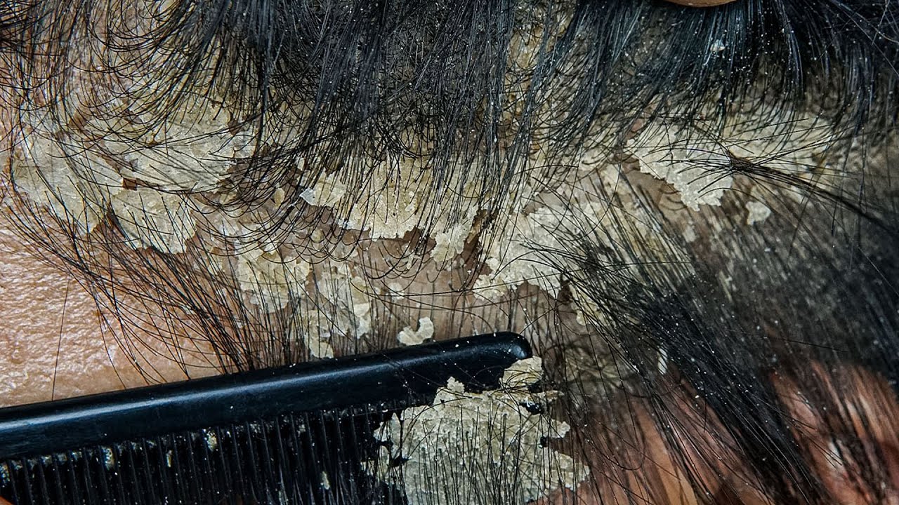 ASMR Super Comfortable Scalp Care #DMO3738