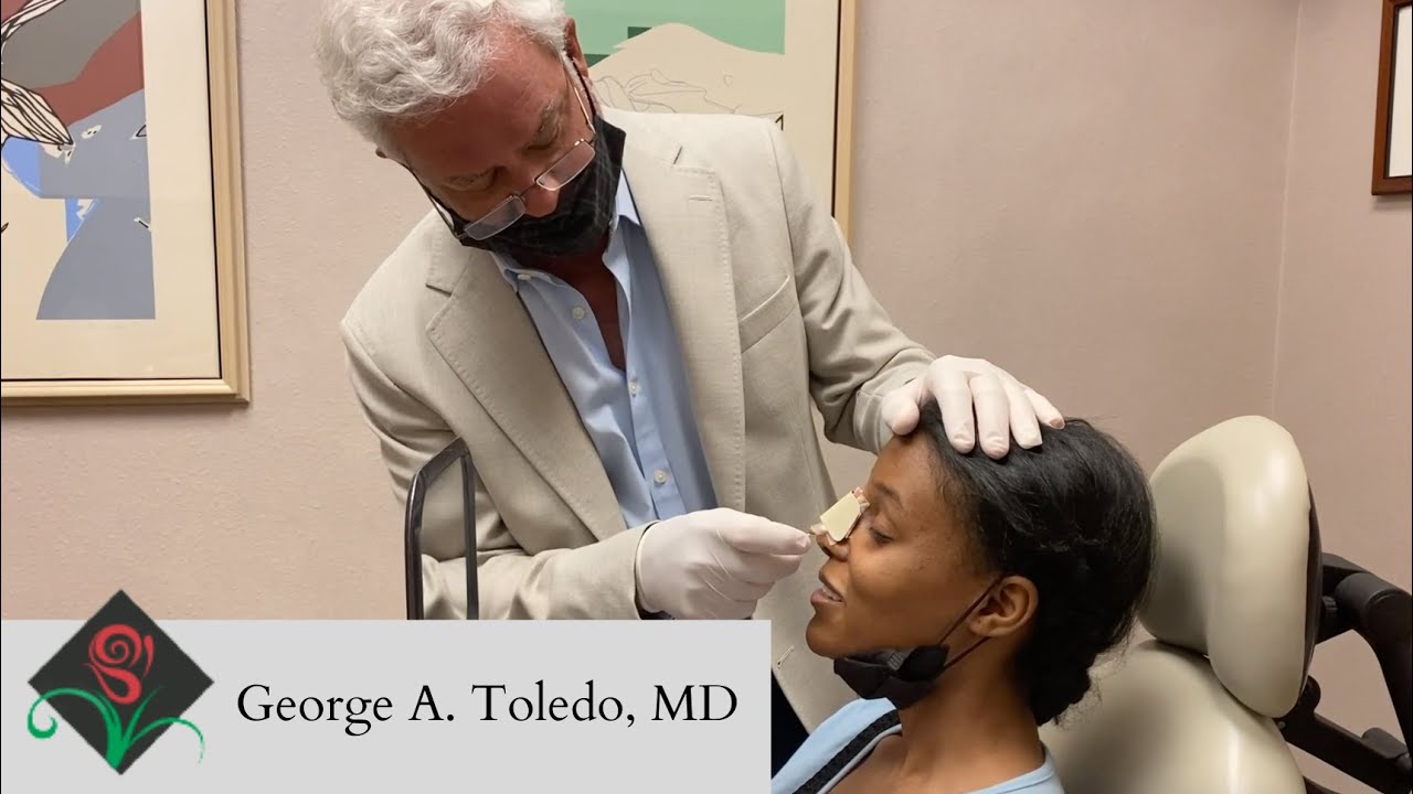 Amazing Ethnic Rhinoplasty Reveal!