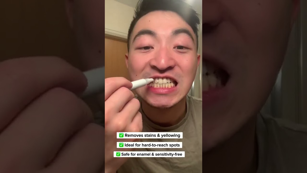 This teeth whitening pen is a game changer 💖  #teeth #smile #dentalcare #teethwhiteningreviews