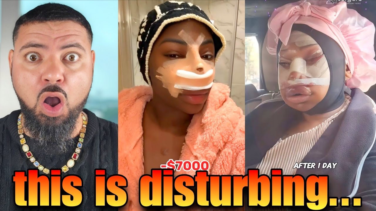 Are Black Women REALLY Going This Far To Be Pretty?