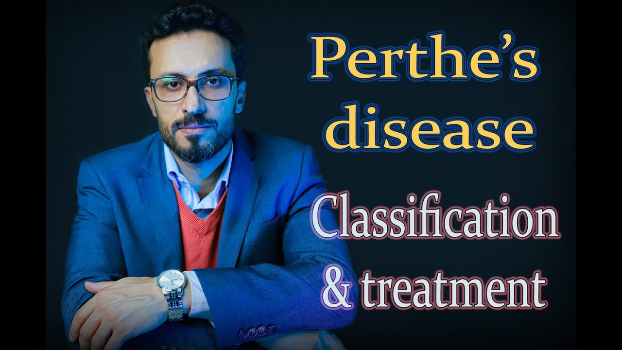03 Perthe's disease: Classifications & Treatment