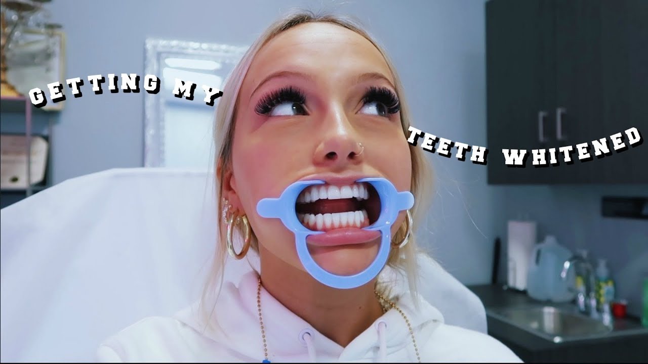 Getting my teeth whitened for the first time...