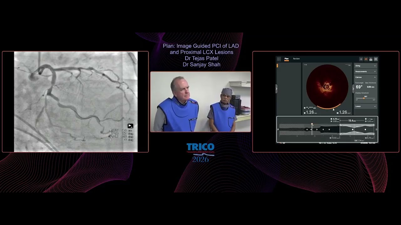 Calcified LAD Extending into Left Main – Orbital Atherectomy Under Crisis | TRICO 2026
