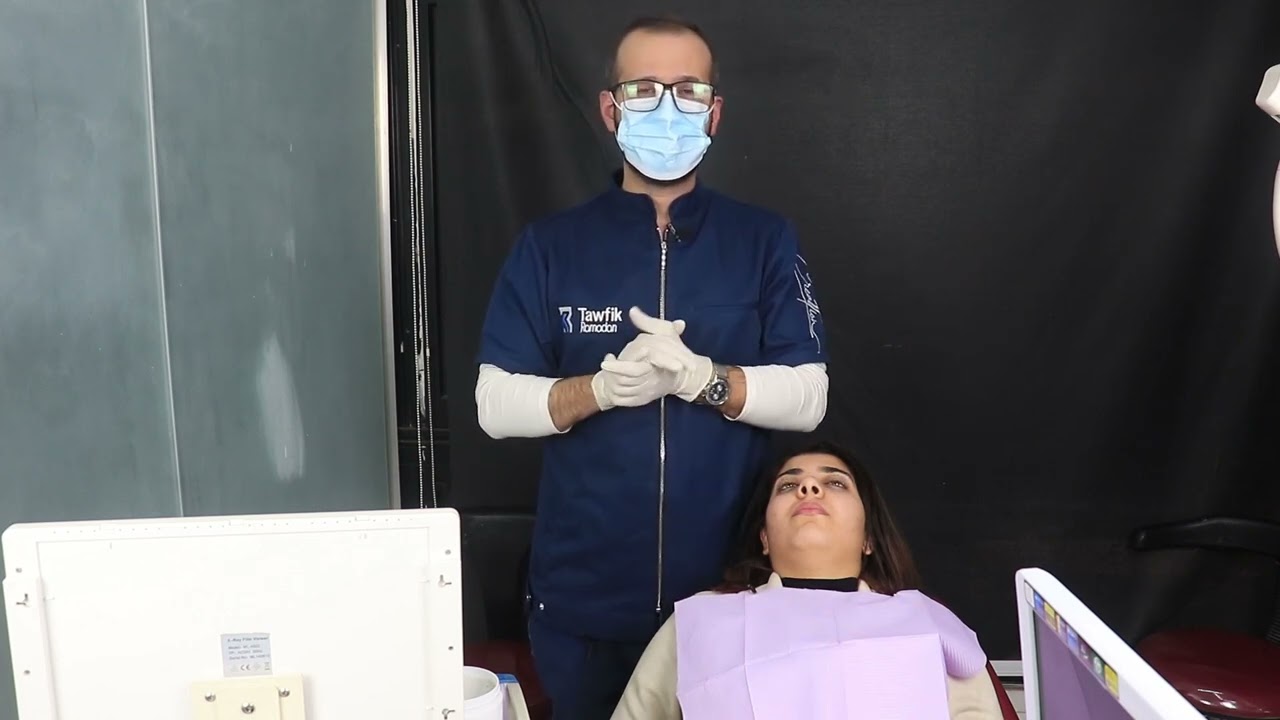 Impressions techniques part 2 🦷👌🏻🪥