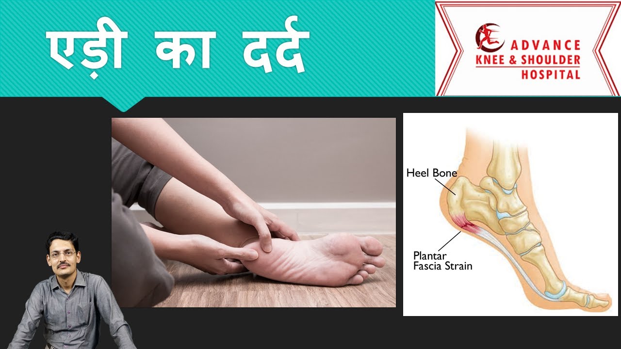 Heel Pain : Plantar Fascitis in Hindi एड़ी का दर्द