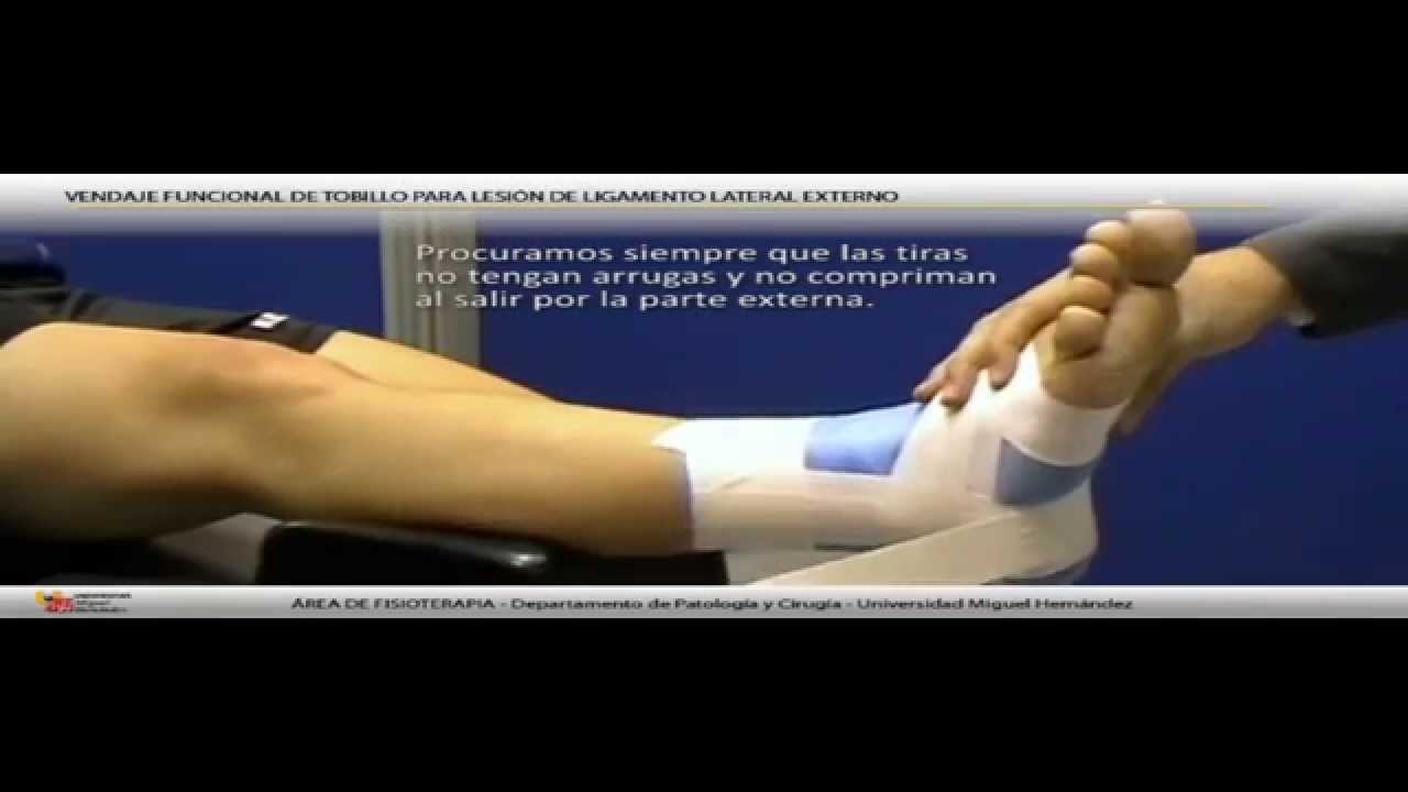 Vendaje funcional de tobillo para lesión de ligamento lateral externo.