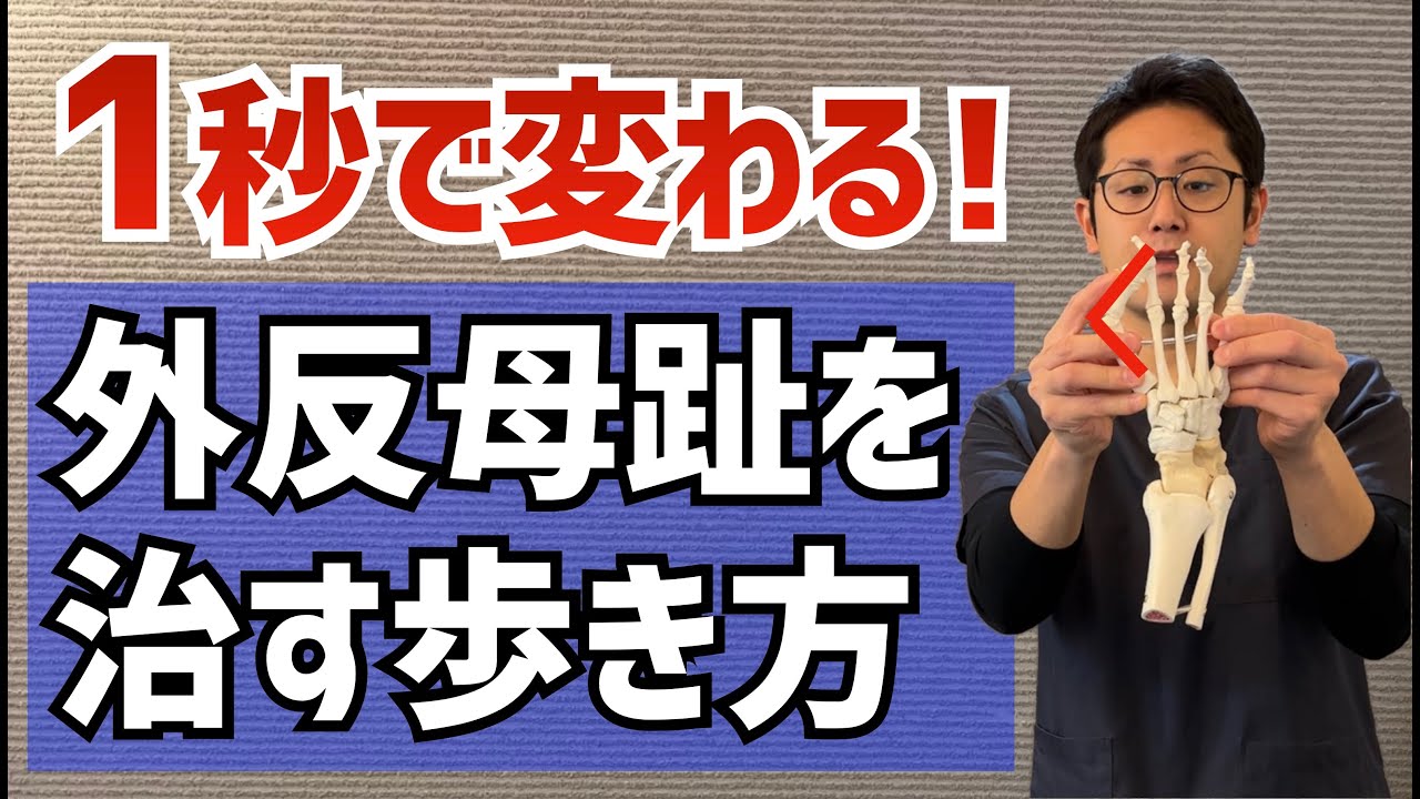 たった1秒！今すぐにできる外反母趾を治す歩き方　｜京都市北区　もり鍼灸整骨院