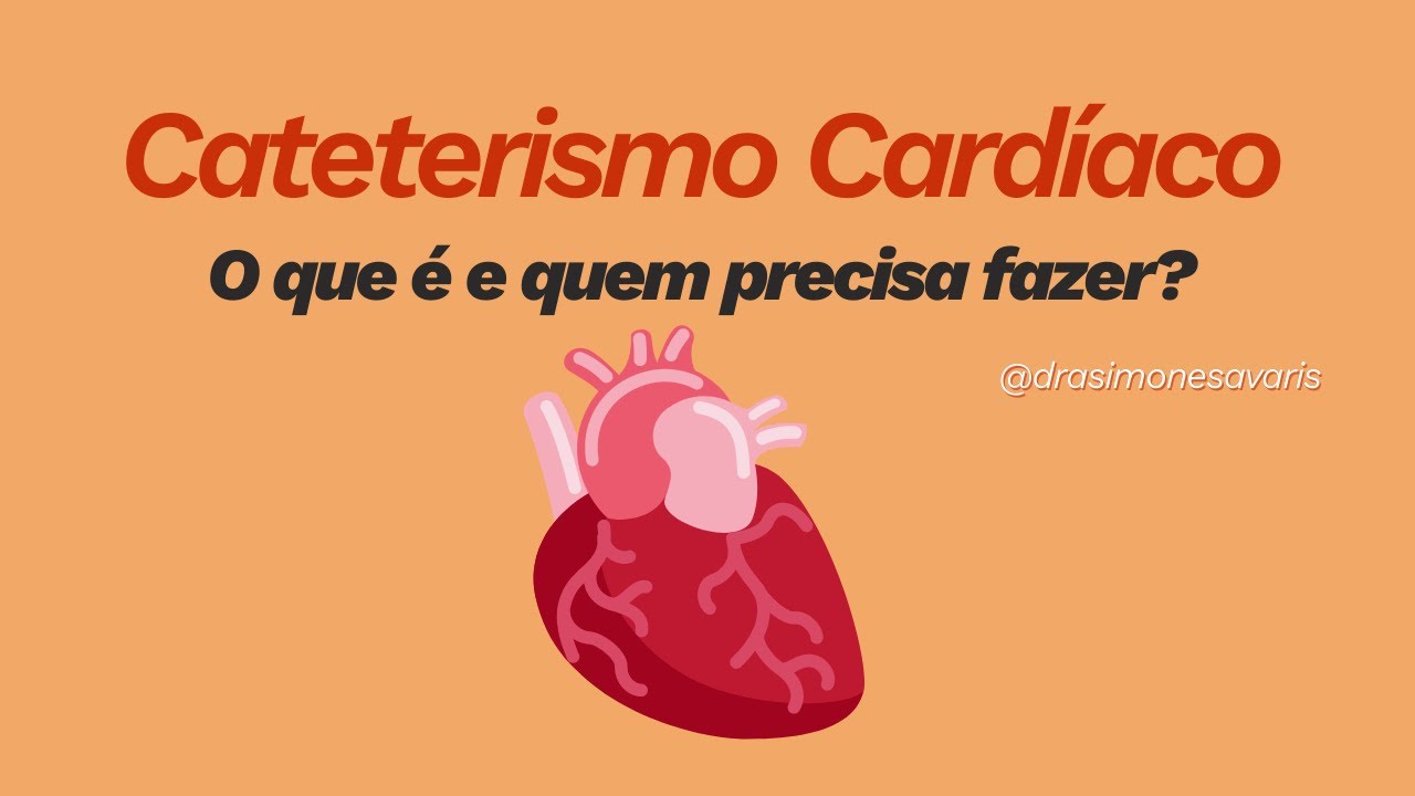 Cateterismo cardíaco: o que é e quem precisa fazer um?