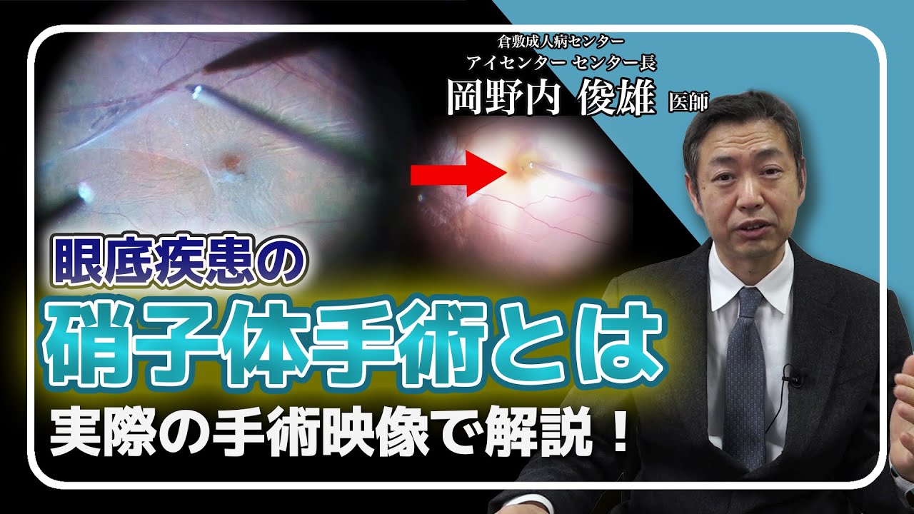 【手術動画あり】中高年に多い目の病気