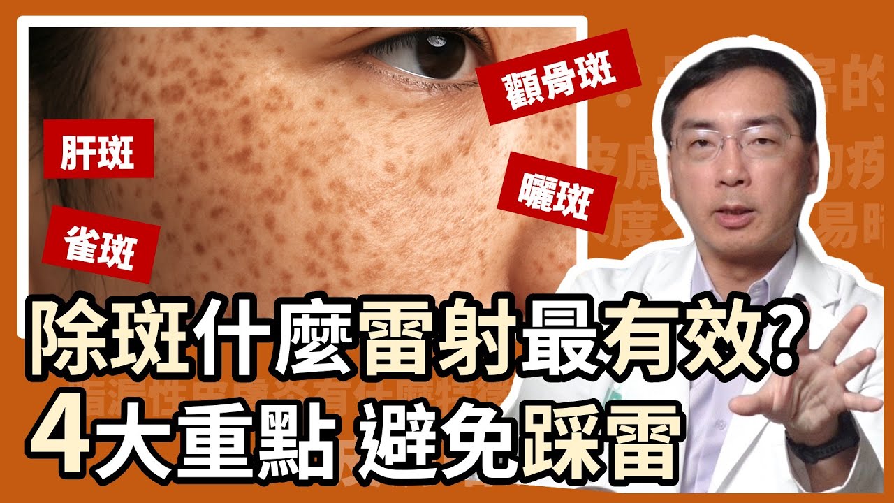 除斑打什麼雷射最有效？4大重點避免踩雷！