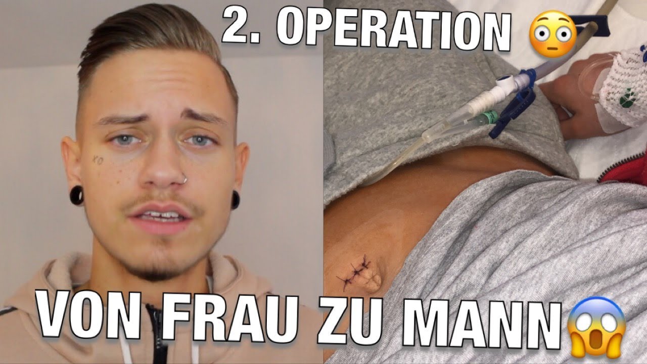 VON FRAU ZU MANN 😳 MEINE 2. OPERATION 😱